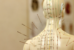 Acupuncture and the Amethyst Biomat