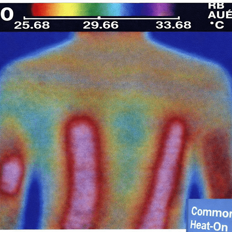Heat from Biomat (1)